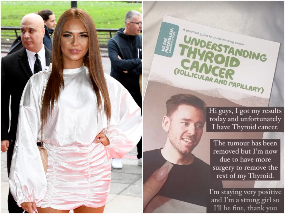 Demi Jones: Love Island star diagnosed with thyroid cancer