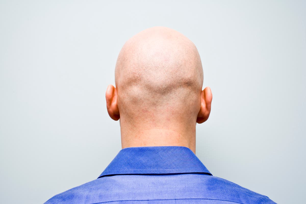Calling man 'bald' is sexual harassment, employment tribunal rules | The  Independent