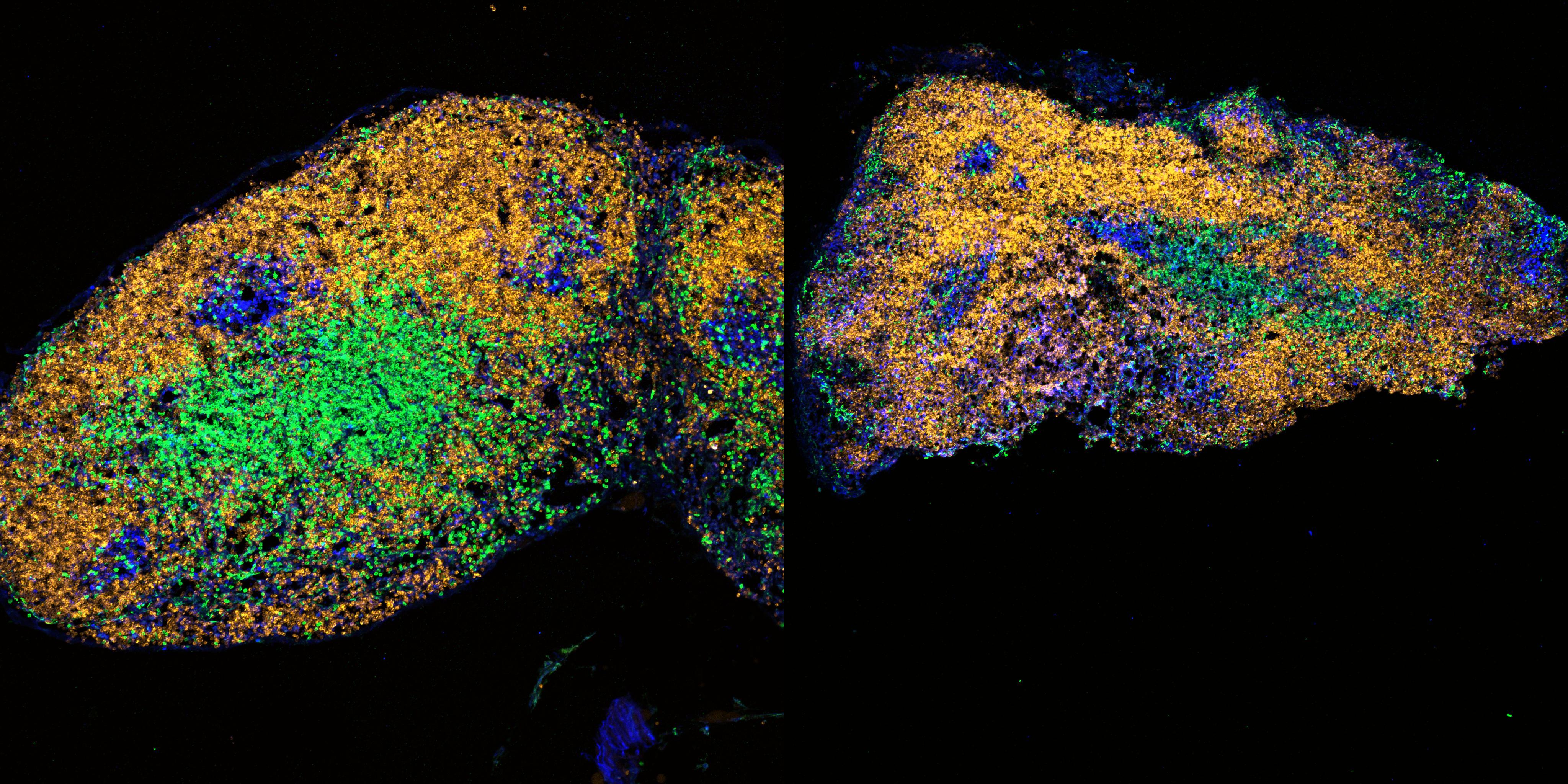 This image shows the lymph node of a young mouse (left) and an old mouse (right). With age, the structure of the lymph node changes and different compartments become less well defined