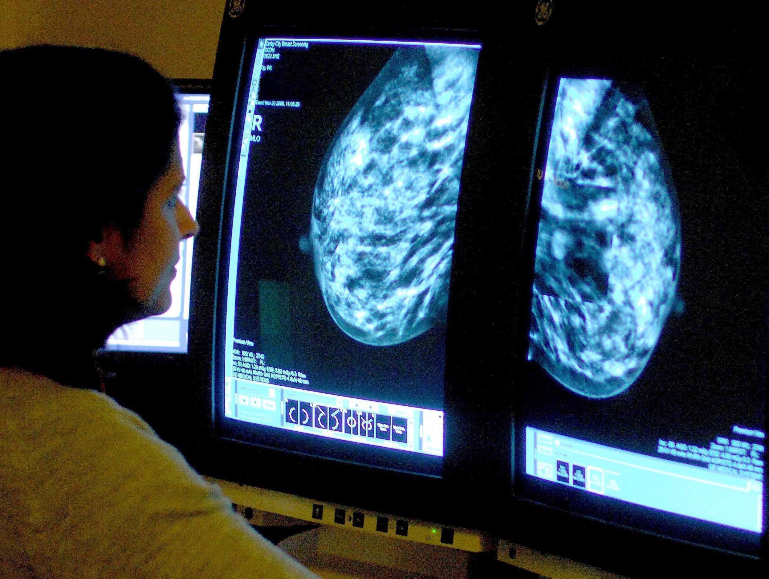 A medical staffer checking a mammogram