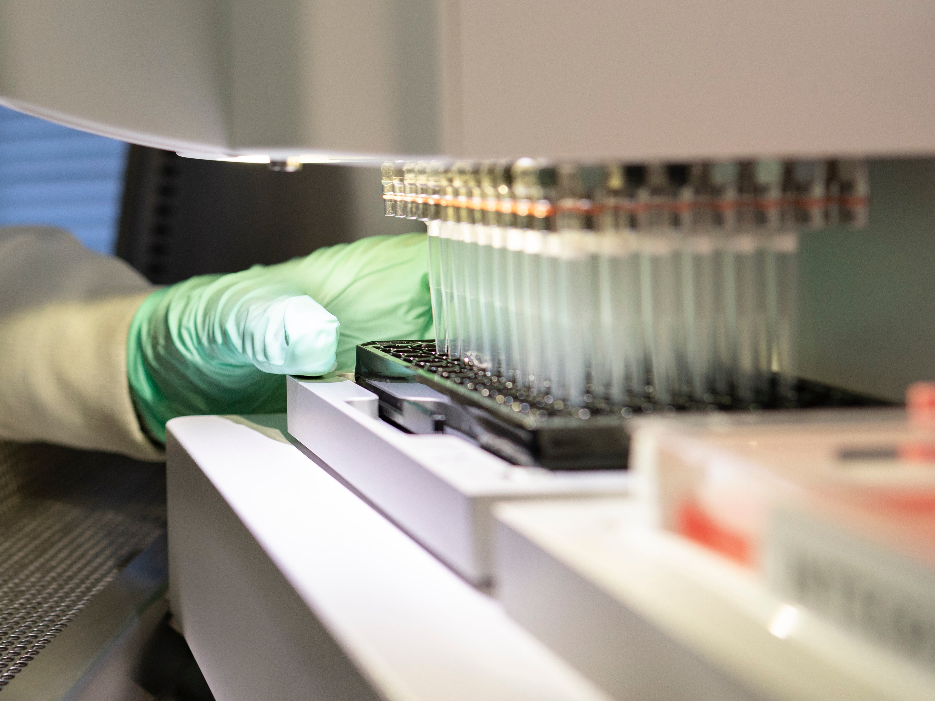 In this 2019 photo provided by Biogen, a researcher works on the development of the medication aducanumab in Cambridge, Massachusetts