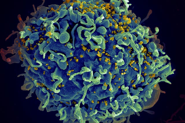 Virus Outbreak HIV
