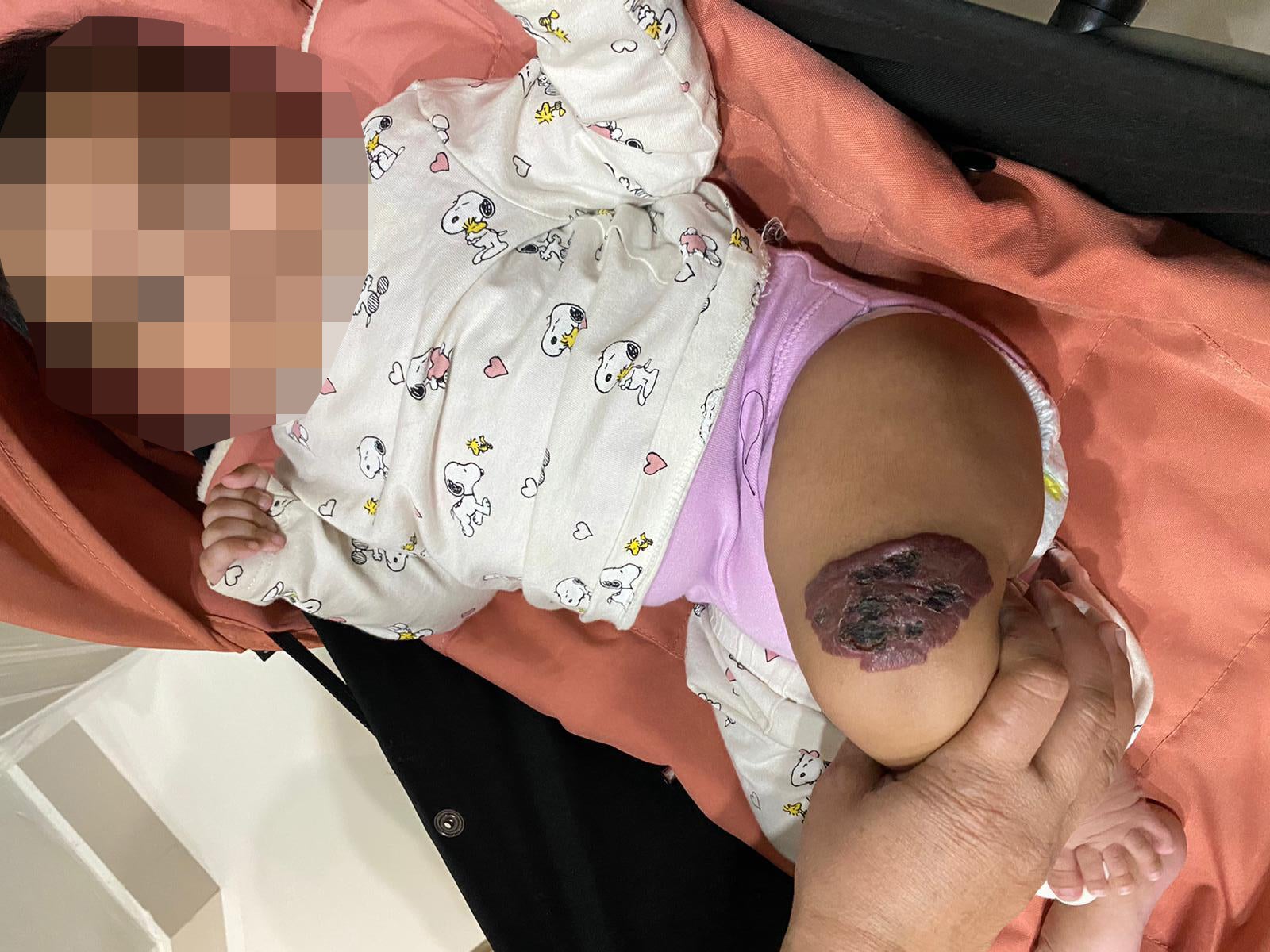 The parents of Aleha, aged four months, waited more than eight hours before being able to take their daughter to hospital for urgent treatment