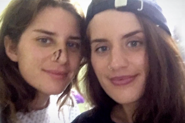 <p>Melissa and Georgia Laurie, 28, pictured for the first time since a crocodile attack on 6 June</p>