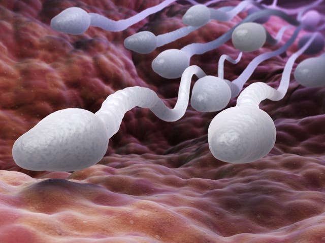 <p>Male sperm cells</p>