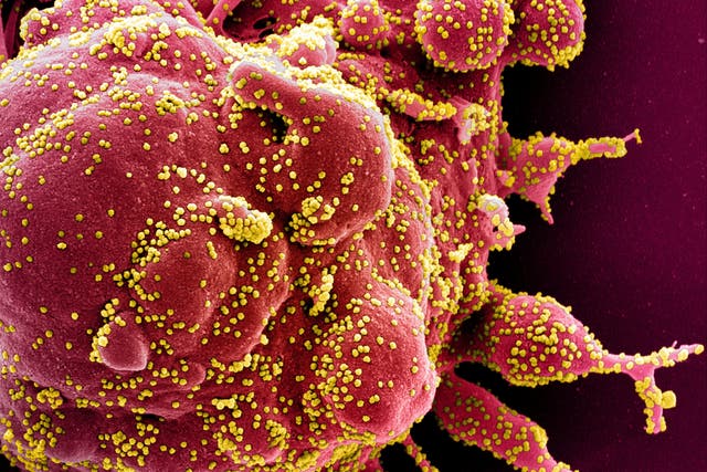 <p>Micrografía electrónica de barrido en color de una célula apoptótica (rojo) infectada con partículas de coronavirus (amarillo) aisladas de una muestra de un paciente</p>