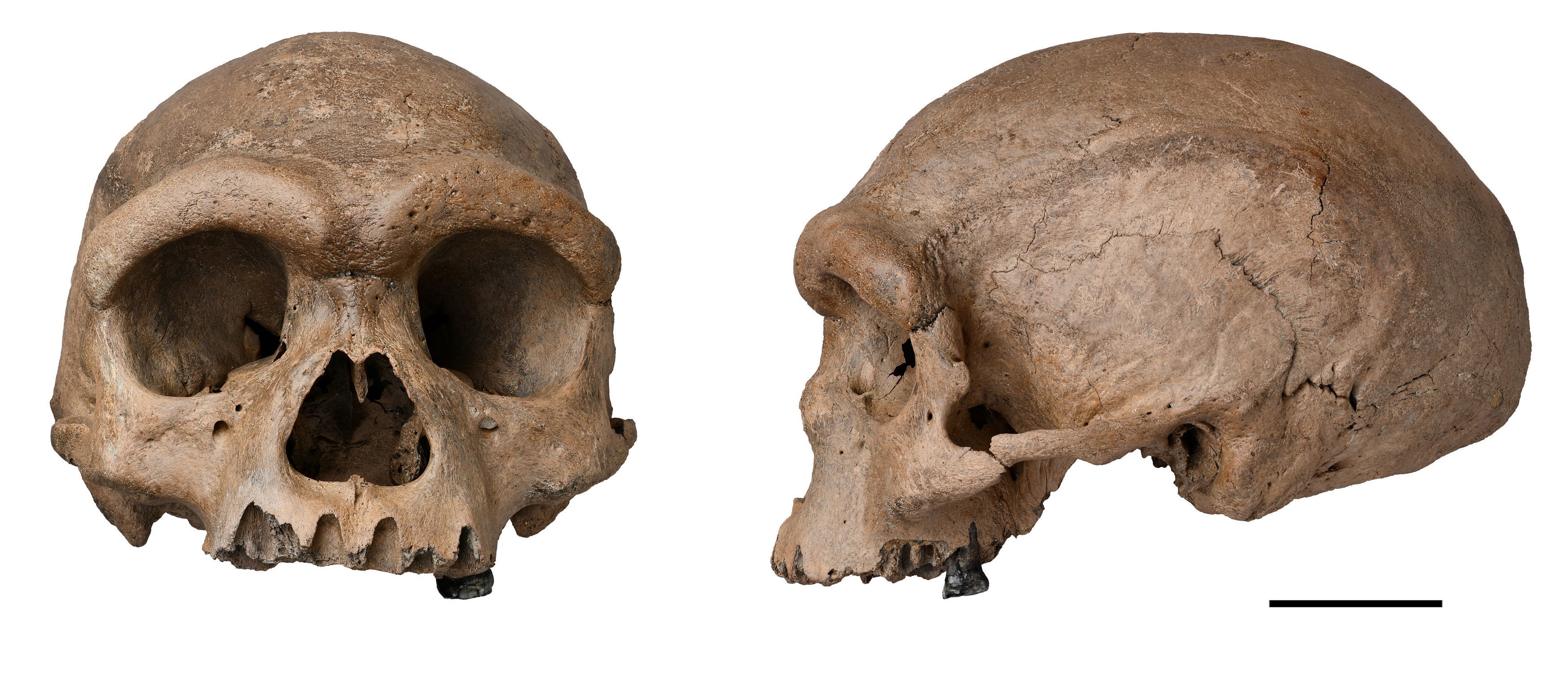 The Harbin cranium, which was reportedly discovered in China in 1933