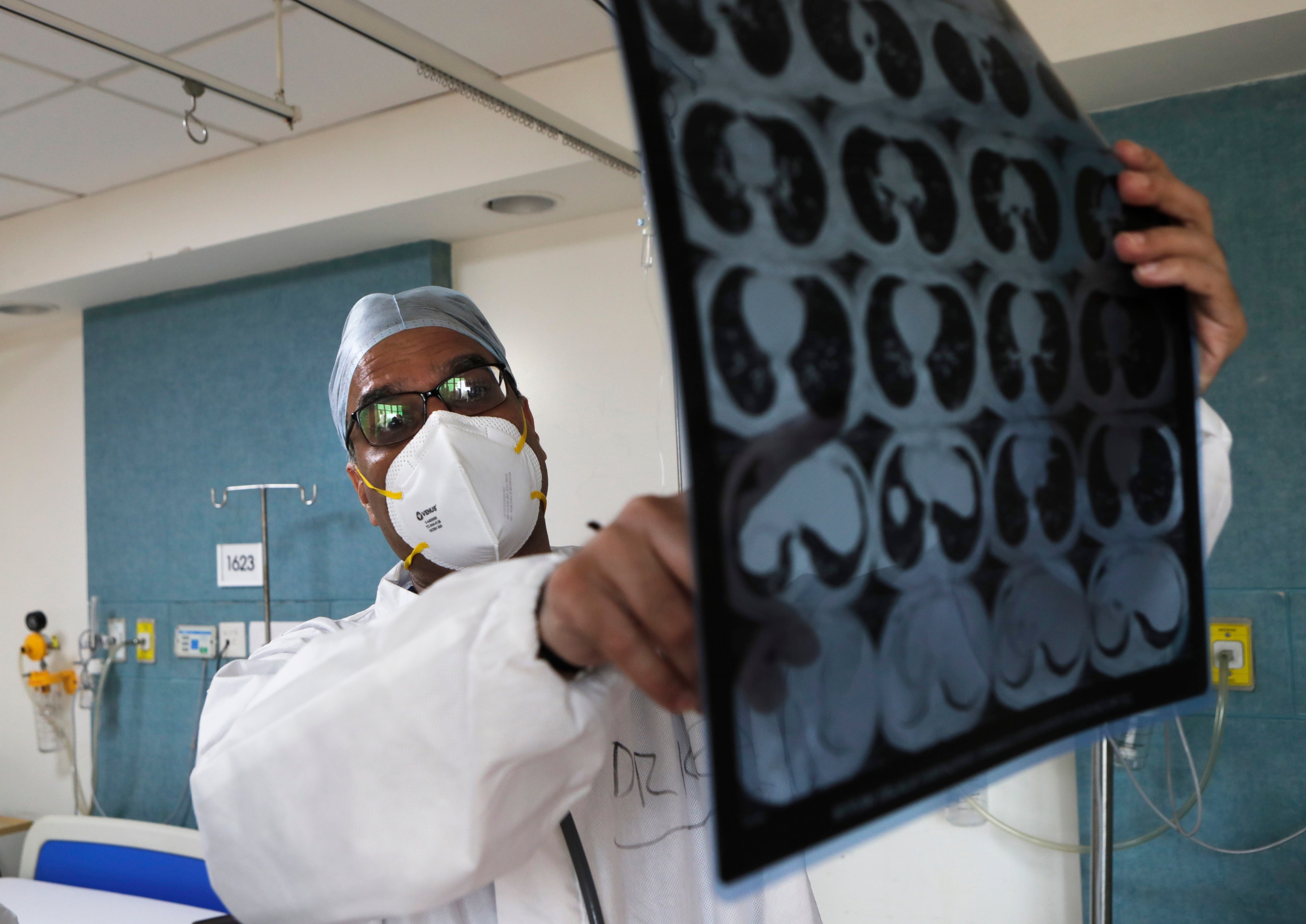 Dr Kedar Toraskar checks the scan report of a Covid-19 patient at the Mumbai Central Wockhardt Hospital in Mumbai, India