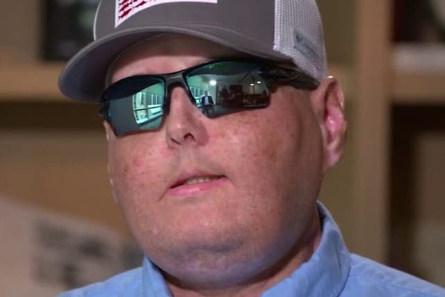 <p>Patrick Hardison, 42, underwent the most extensive face transplant surgery to date in 2016. </p>