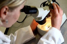 New ovarian cancer treatment shrinks tumours in nearly half of patients in trial, results show