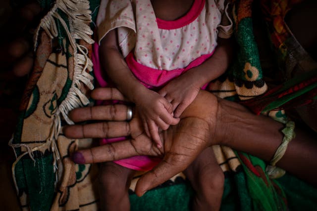 <p>In Ethiopia’s war-ravaged Tigray region, more than 350,000 people are experiencing famine-like conditions</p>