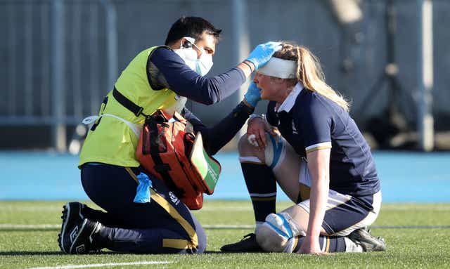 <p>A new report has called for common protocols and better reporting for head injuries (Andrew Milligan/PA)</p>