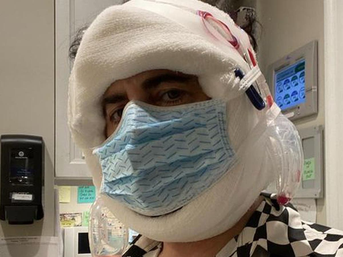 Marc Jacobs shares bandaged photo of himself after facelift