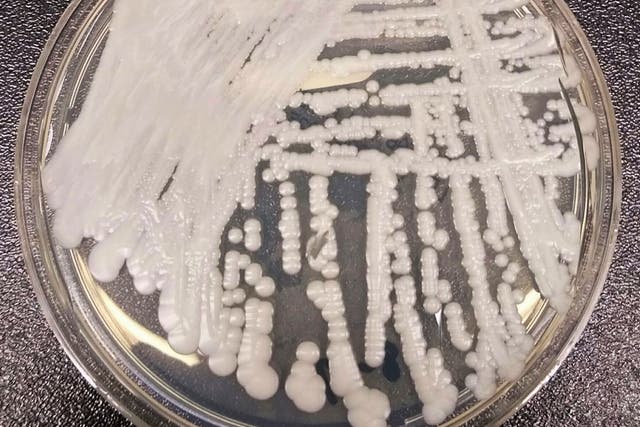 <p>A strain of Candida auris cultured in a petri dish at a CDC laboratory</p>