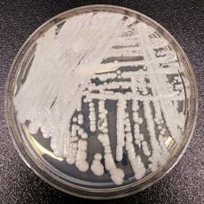 A CDC warning and a fungus outbreak: Everything we know about the deadly candida auris