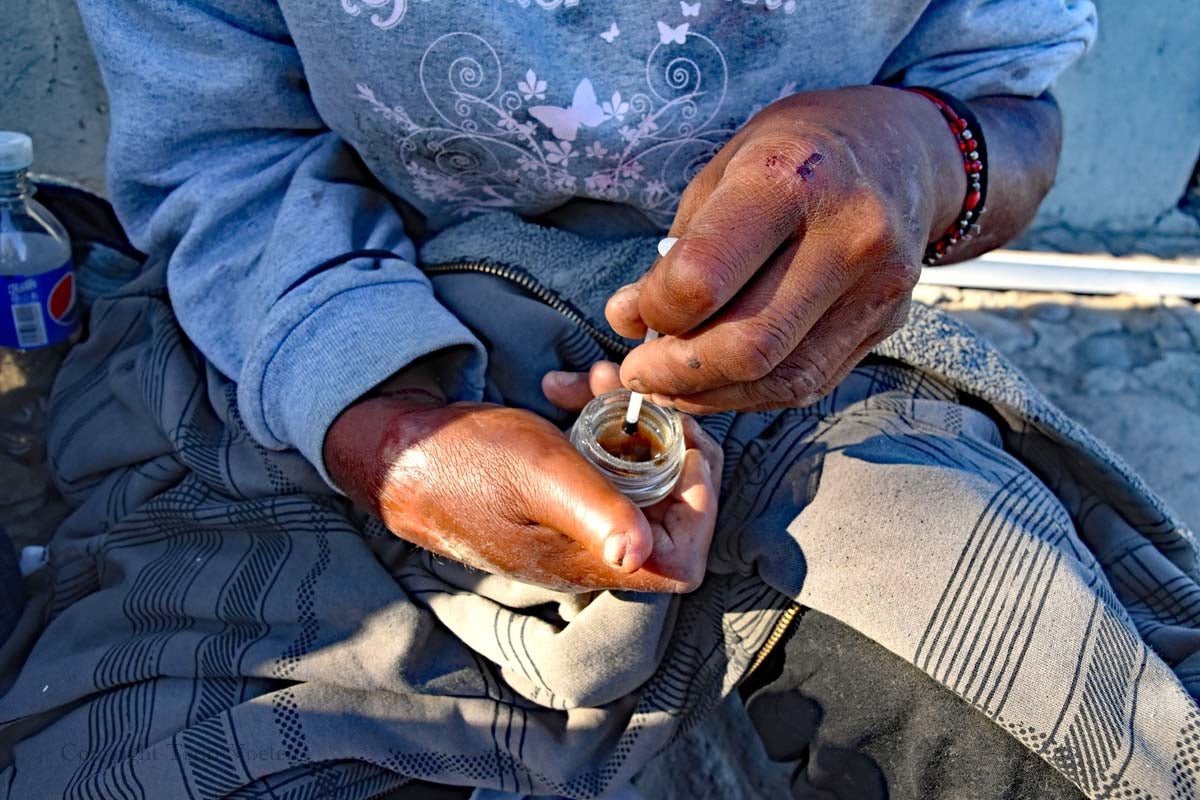 José stirs brown fluid in a glass jar, a mixture of meth and heroin