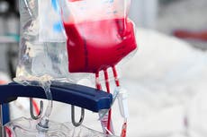 Critical call for Black people to donate blood as ‘number of sickle cell patients grows’