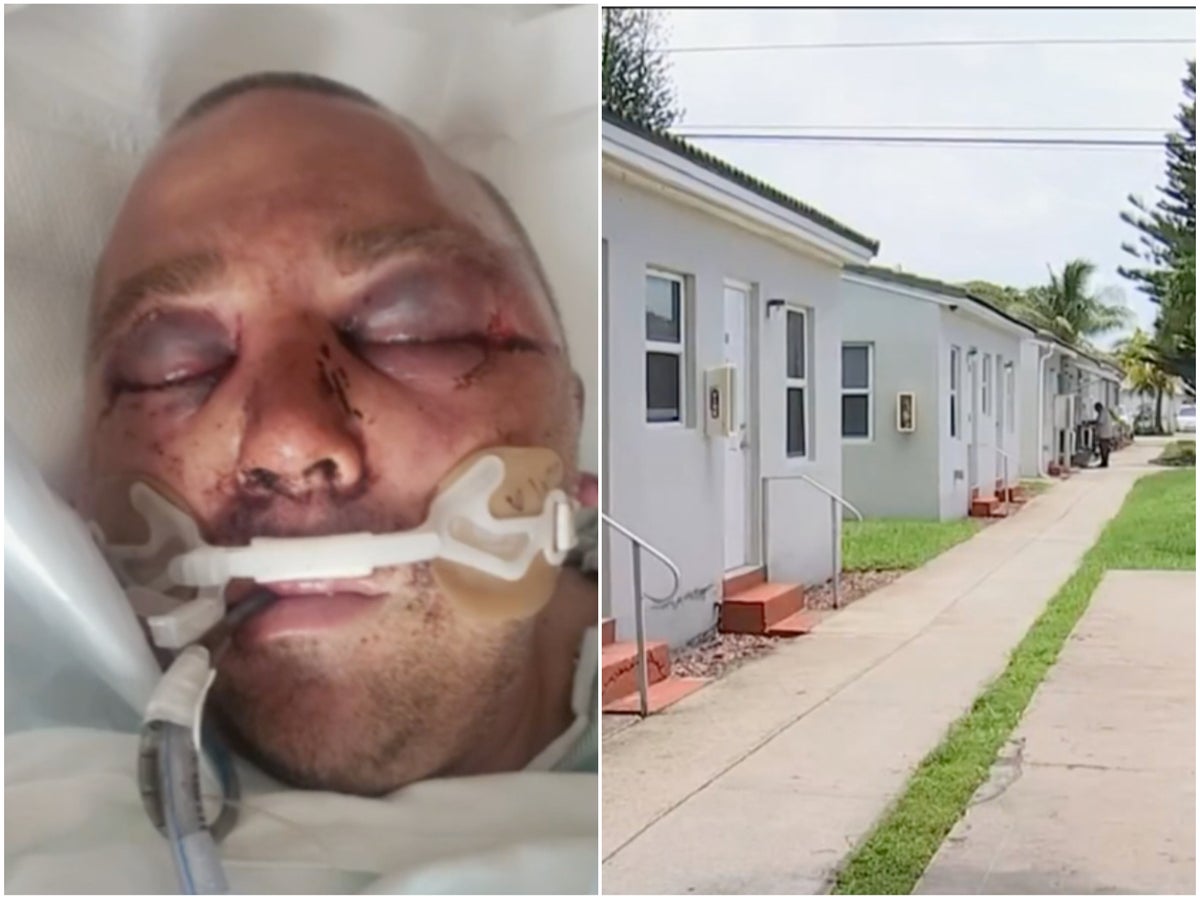 Florida man &#39;beaten into a coma&#39; after asking neighbors to turn music down | indy100