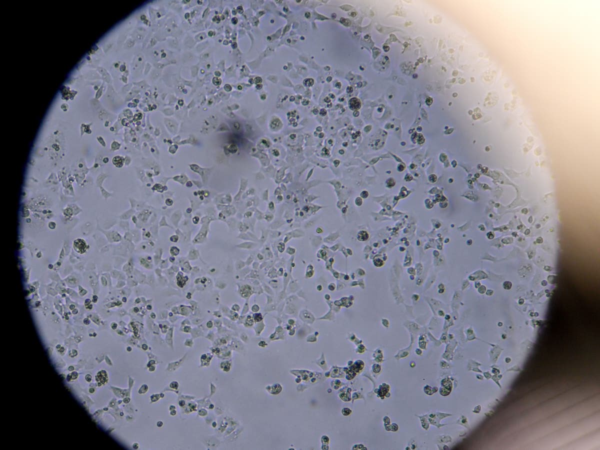 The &lsquo;possibilities are endless&rsquo; &ndash; or are they? The evolutionary journey that Covid could take