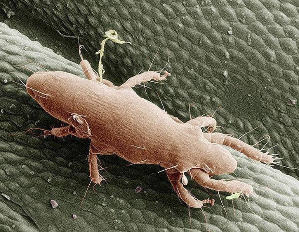 Washington DC is suffering an itch mite infestation