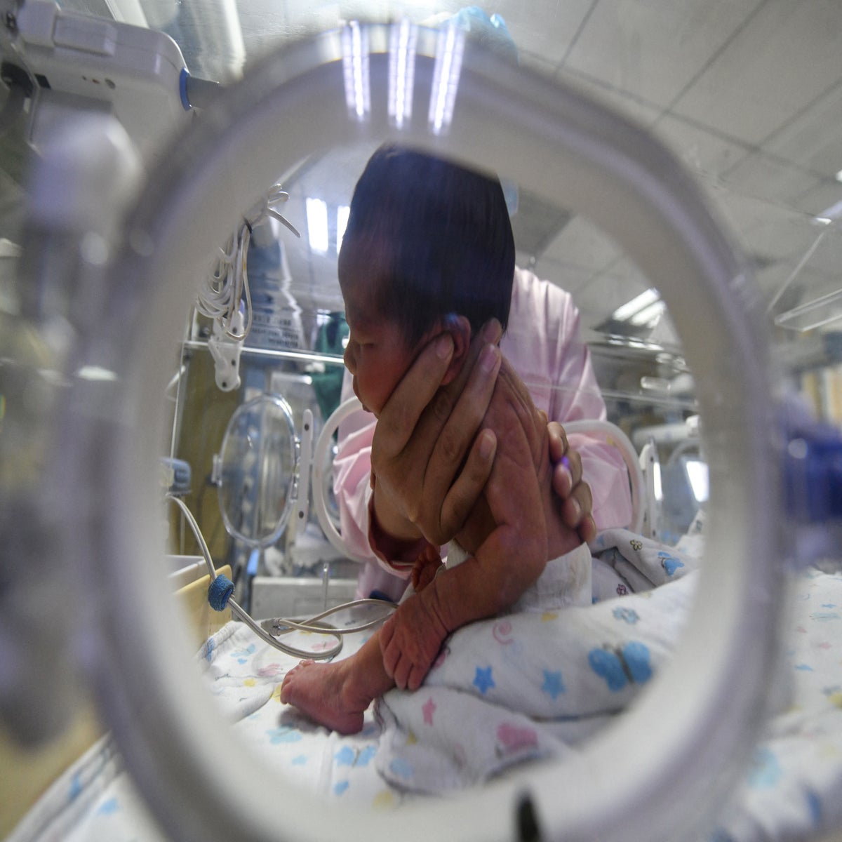 World's smallest baby in incubator