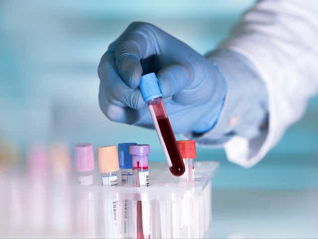 <p>Officials working with the NHS have warned that issues with shortages for blood test tubes will likely continue until September</p>