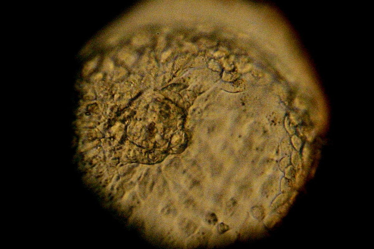 A human embryo seen through a microscope