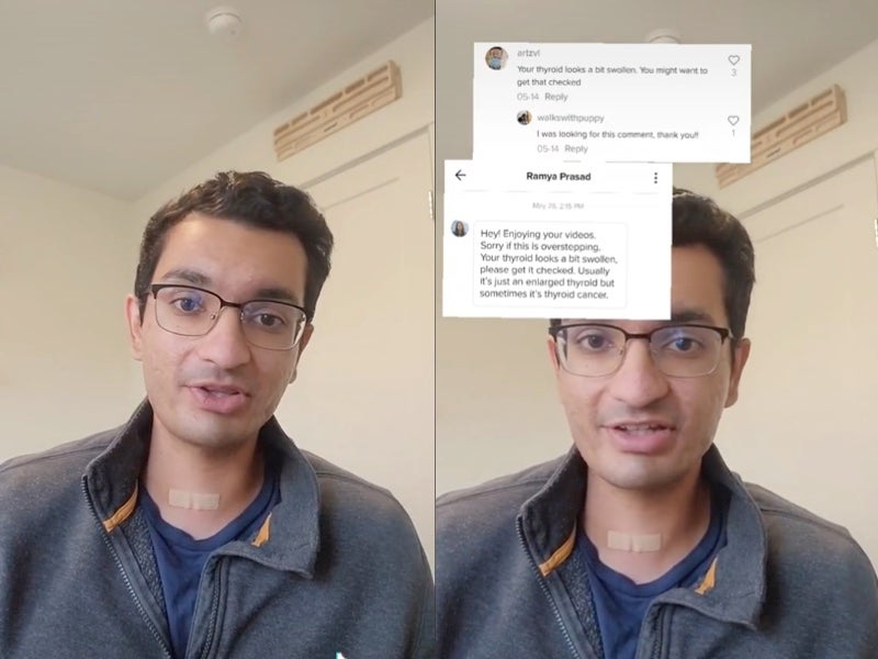 TikTok user reveals he underwent surgery after viewers encouraged him to have thyroid checked for cancer