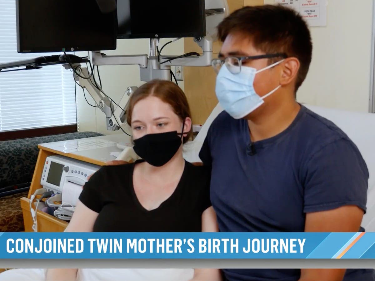 Woman born as conjoined twin gives birth at same hospital where she was