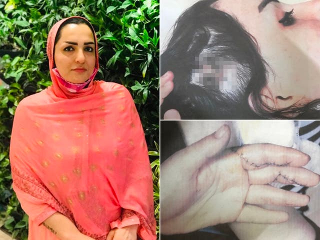 <p>Fariba Akemi was married to a Taliban fighter in Herat city. ‘He attacked me at four places on my body. I still carry the scars on my neck, my arms and my two fingers do not work’ </p>