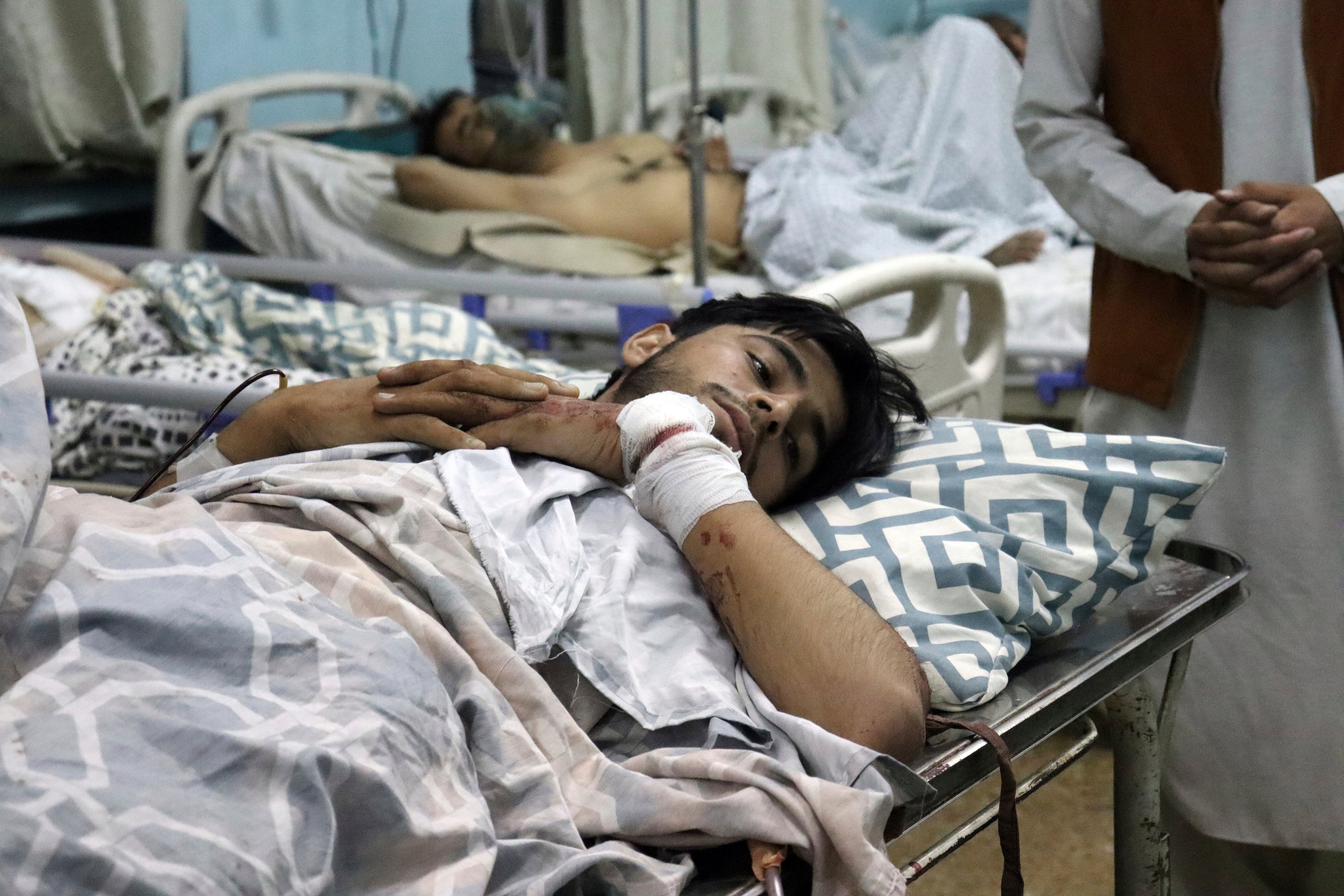 An Afghan man lies on a bed at a hospital after he was wounded in the deadly attacks outside the airport in Kabul