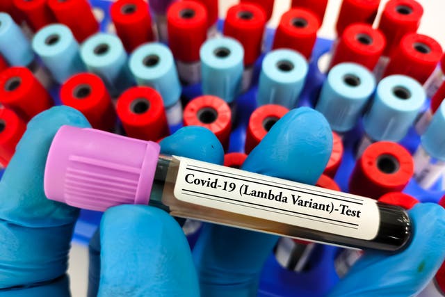 <p>La variante  Lambda ha sido encontrada en al menos 40 países en el mundo </p>