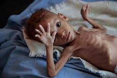 Groups: Both sides used starvation as tool in Yemen war
