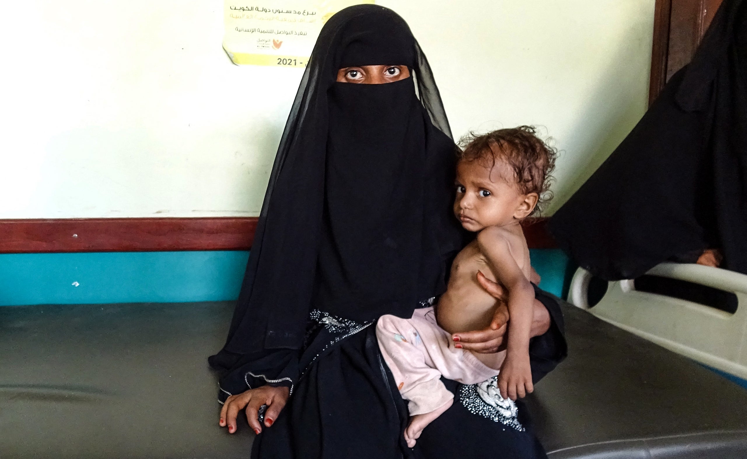A Yemeni woman holds a malnourished child at a clinic in the war-ravaged western province of Hodeida