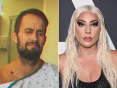 Lady Gaga defended by man who got shot while protecting her dogs in Hollywood abduction