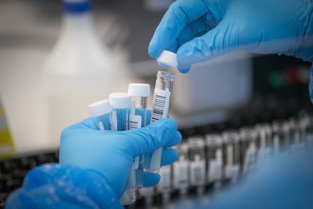 A PCR testing company is under investigation by the Competition and Markets Authority (Jane Barlow/PA)