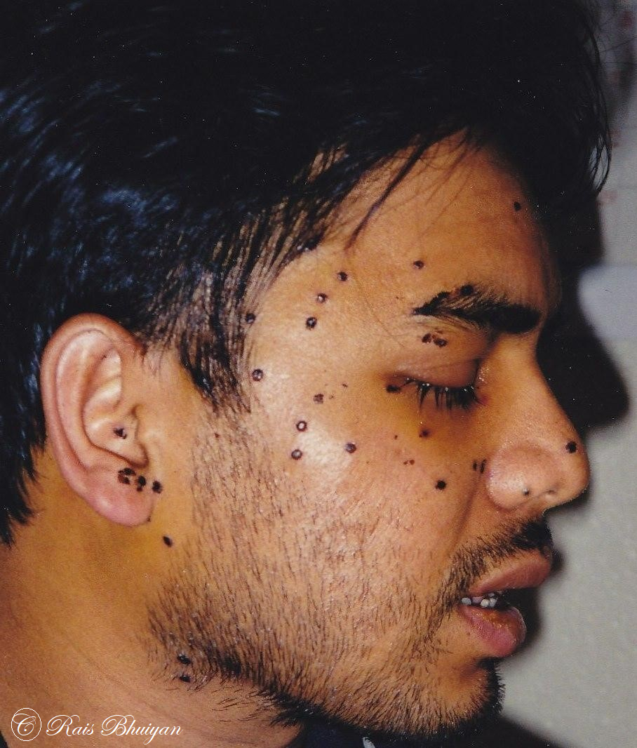 On 21 September, 2001, a white supremacist named Mark Stroman shot Rais Bhuiyan at close range in the convenience store where he worked in Dallas, Texas, one of numerous hate crimes targeting Muslims after 9/11.
