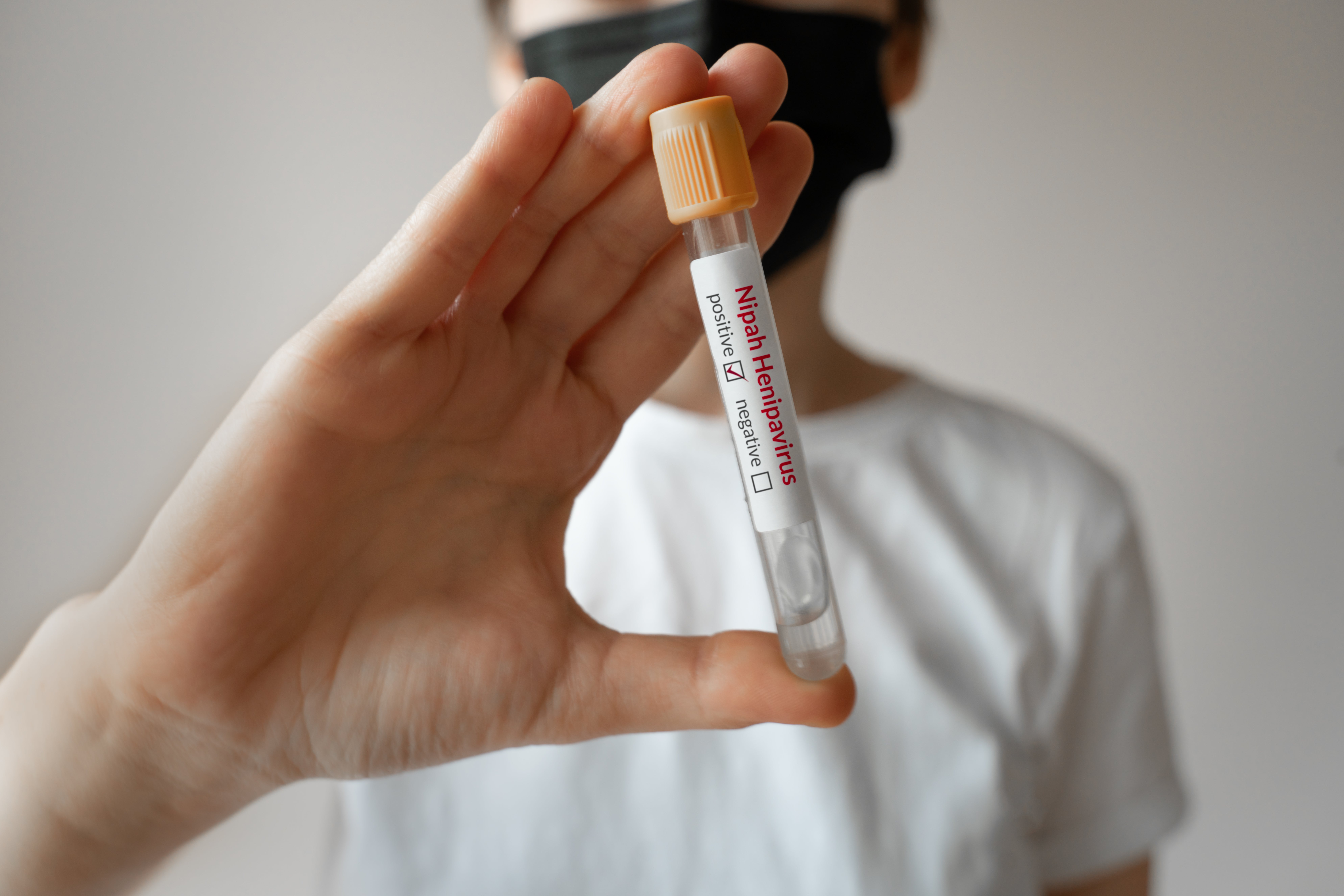 <p>Este virus se transmite a los humanos a través de los murciélagos frugívoros  </p>