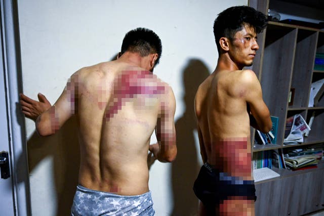 <p>Afghan newspaper Etilaat-e Roz journalists Nemat Naqdi (L) and Taqi Daryabi show their wounds after being released from Taliban custody in Kabul in a picture taken on 8 September 2021</p>