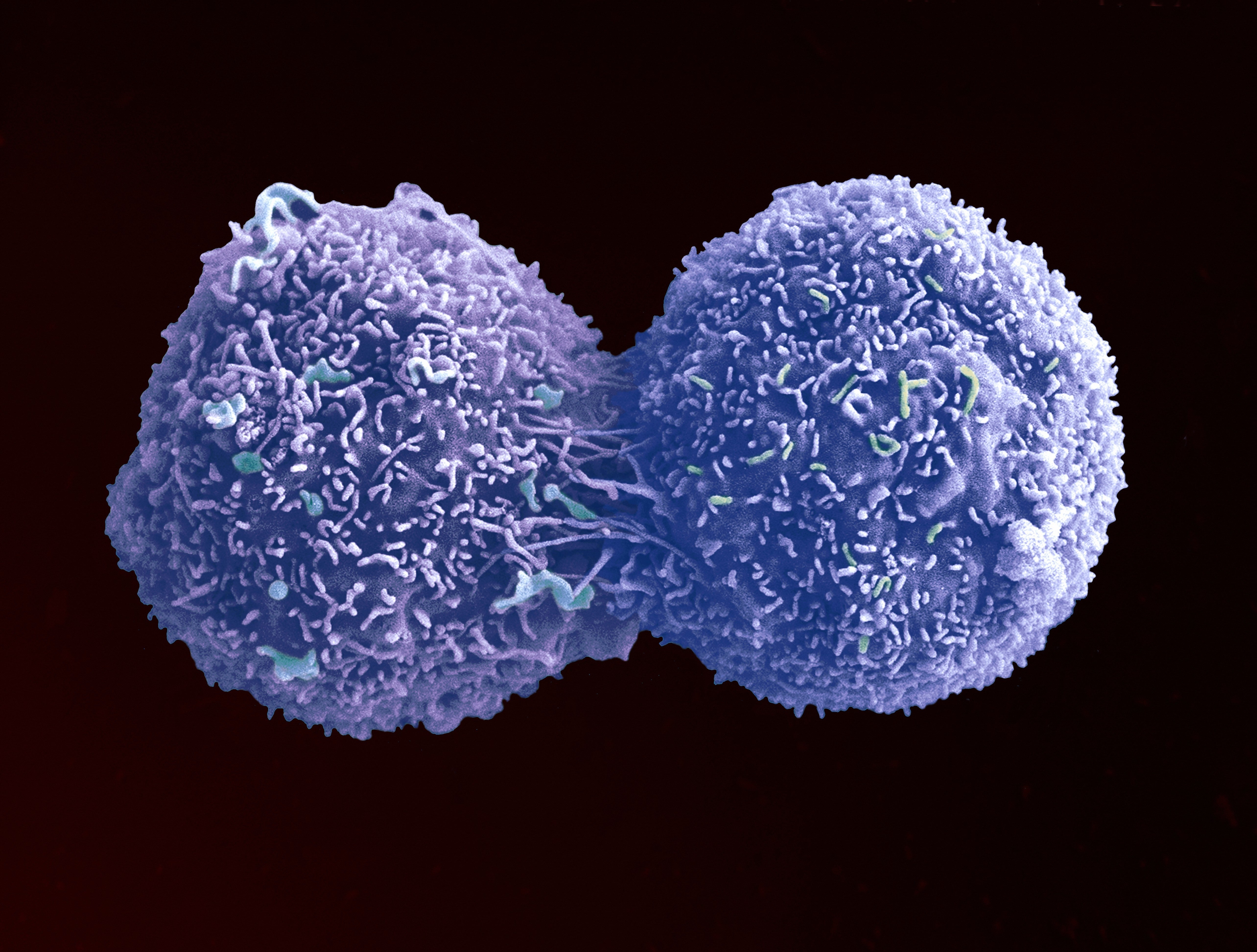 A lung cancer cell dividing, captured by the Wellcome Trust