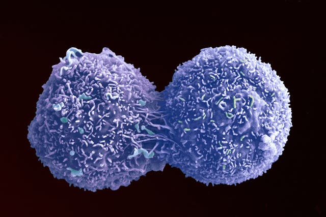 <p>A lung cancer cell dividing, captured by the Wellcome Trust </p>