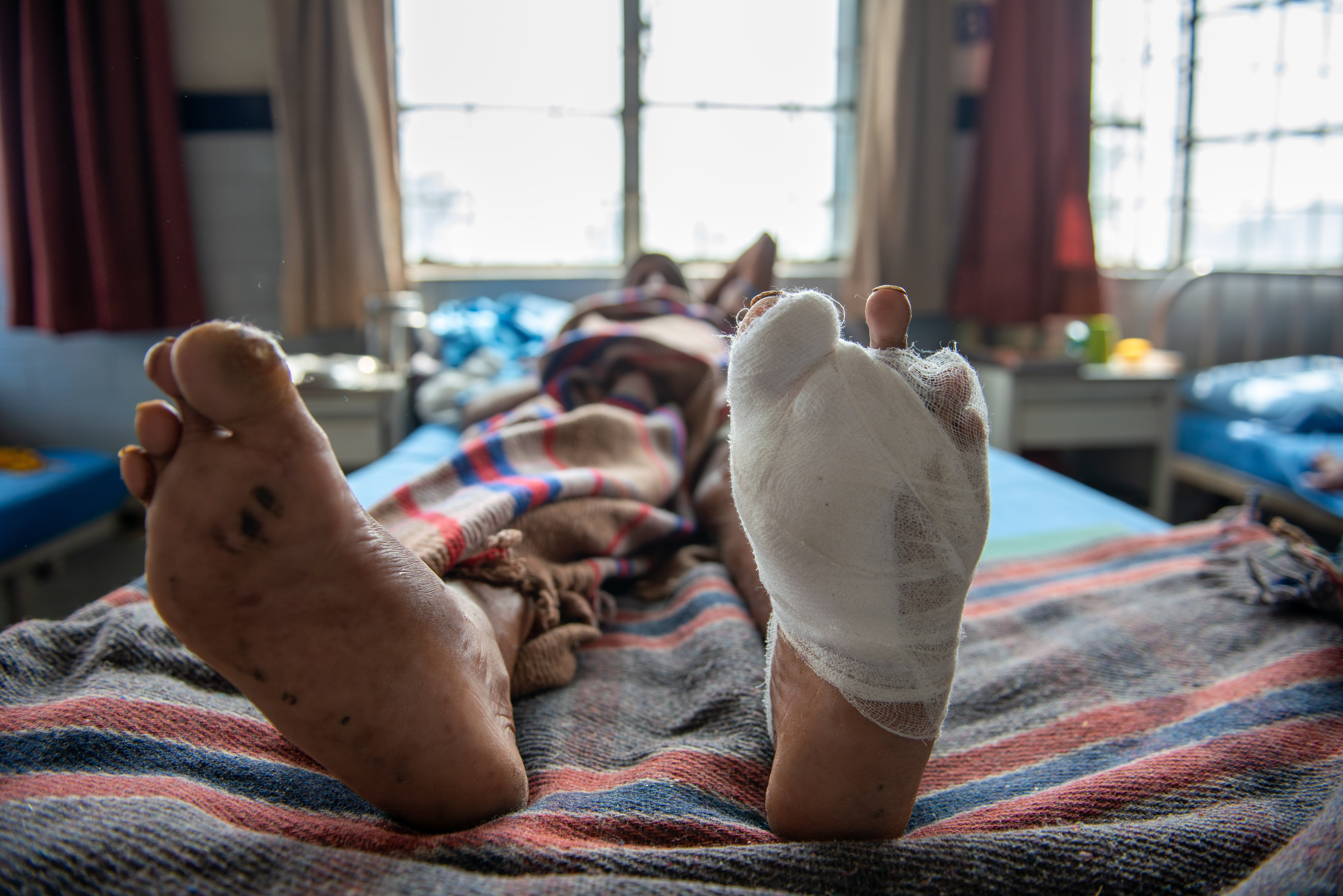 <p>Chile no ha reportado un caso de lepra desde 2017 </p>