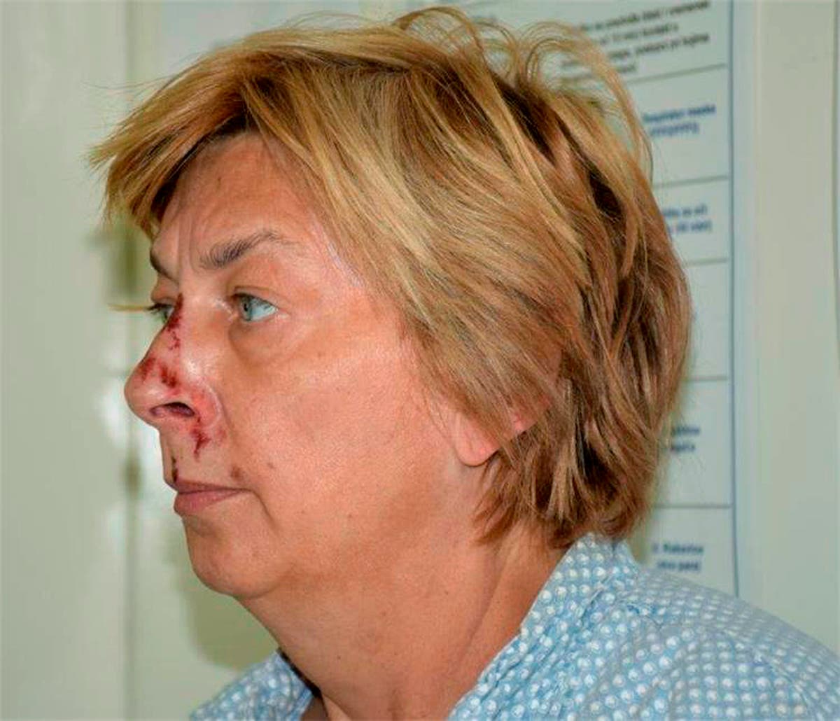 Croatian police identify woman found with memory loss