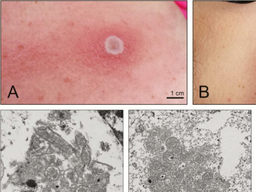 Images of the virus known as “Alaskapox”