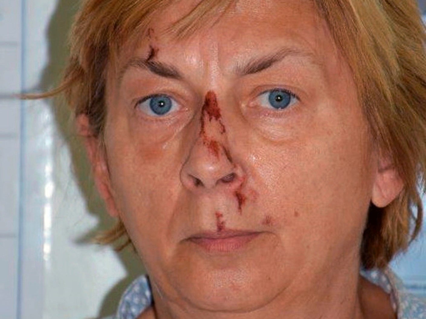 The woman was found with no memory, and with cuts and bruises to her face, on 12 September