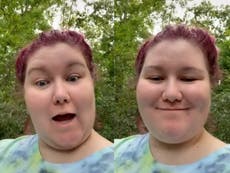 Woman calls out ‘double standard’ in ‘what I eat in a day’ videos on TikTok: ‘Thin privilege, fat phobia’