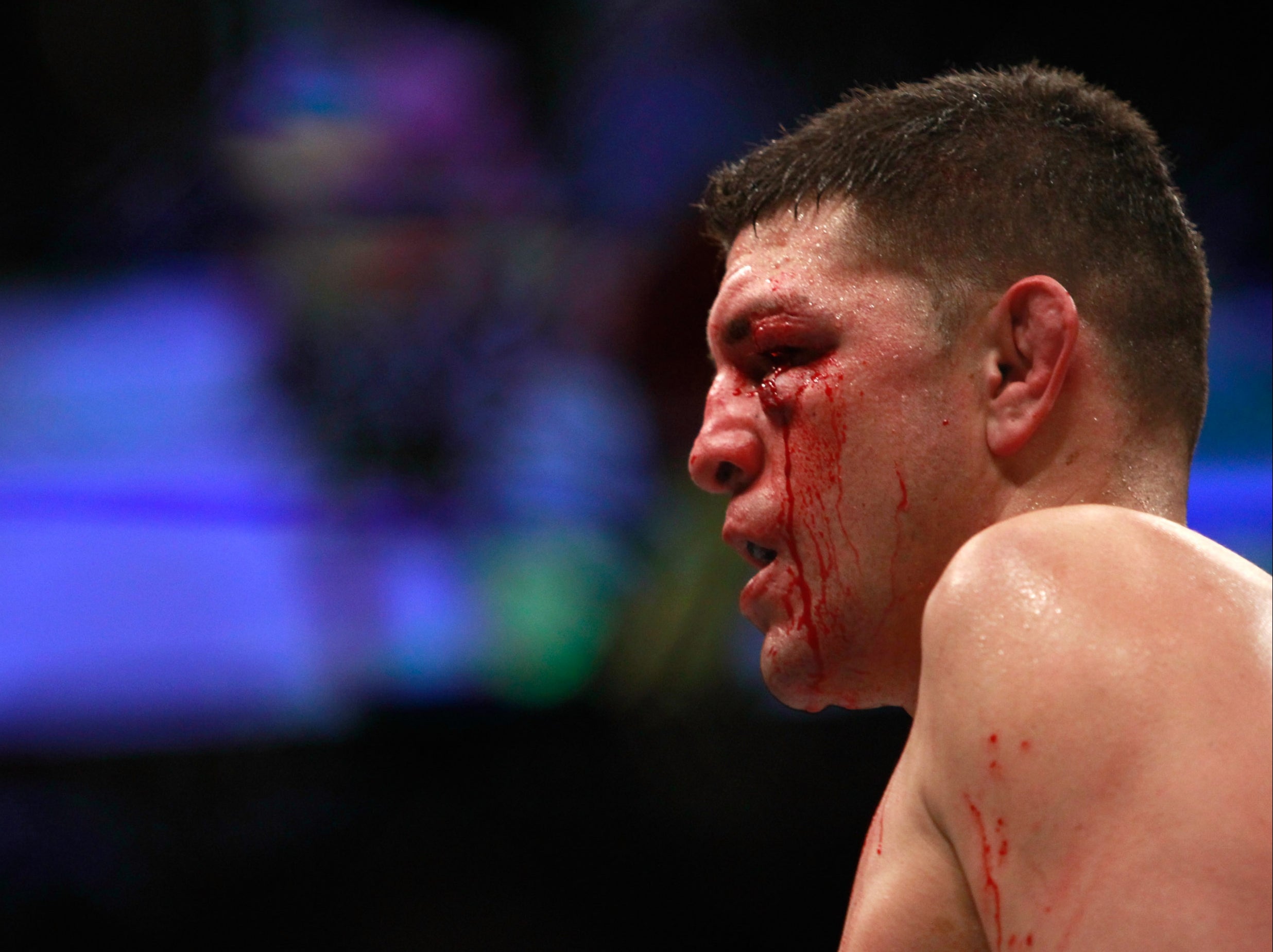 Nick Diaz during his last bout, against Anderson Silva in 2015