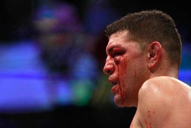 <p>Nick Diaz during his last bout, against Anderson Silva in 2015</p>