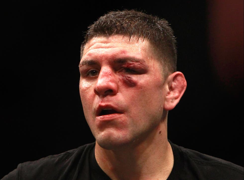 <p>Nick Diaz after his last UFC bout, in 2015</p>