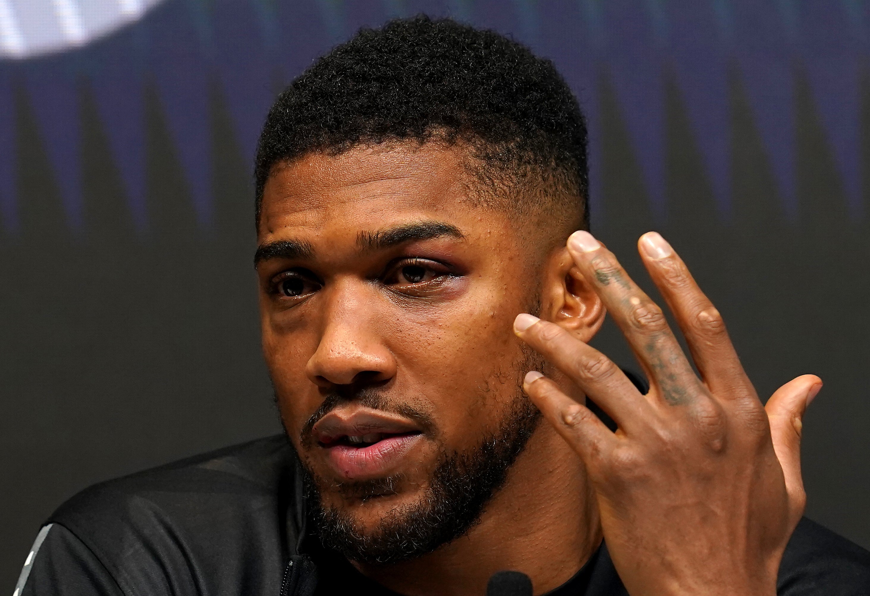 Anthony Joshua’s battle scars were on show in his post-fight press conference (Nick Potts/PA)